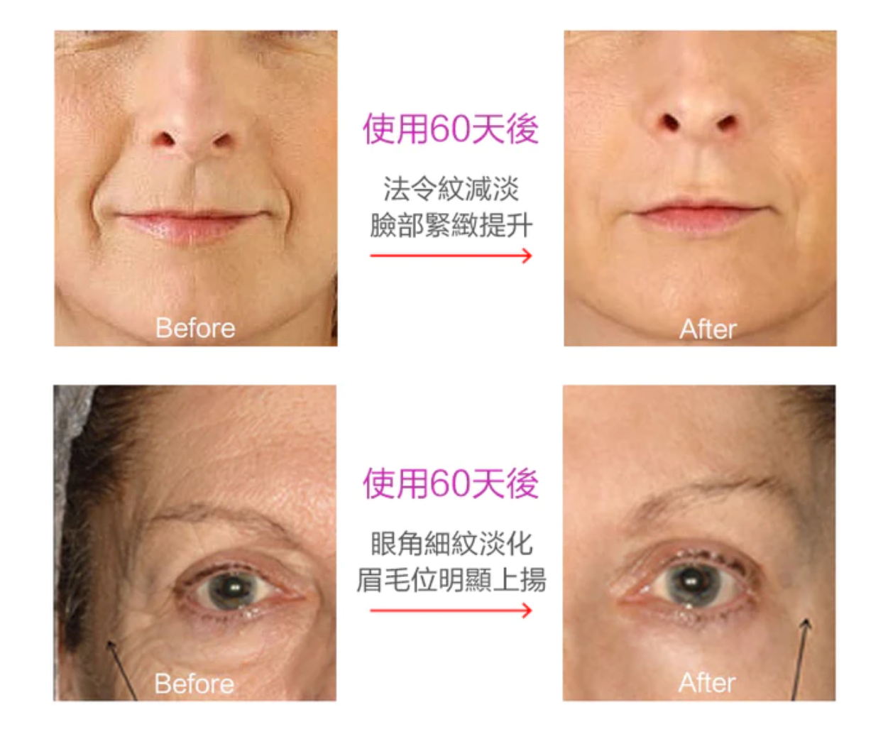BIOCYTE ACTIV' 貝茜 抗糖去皺丸 使用60日後