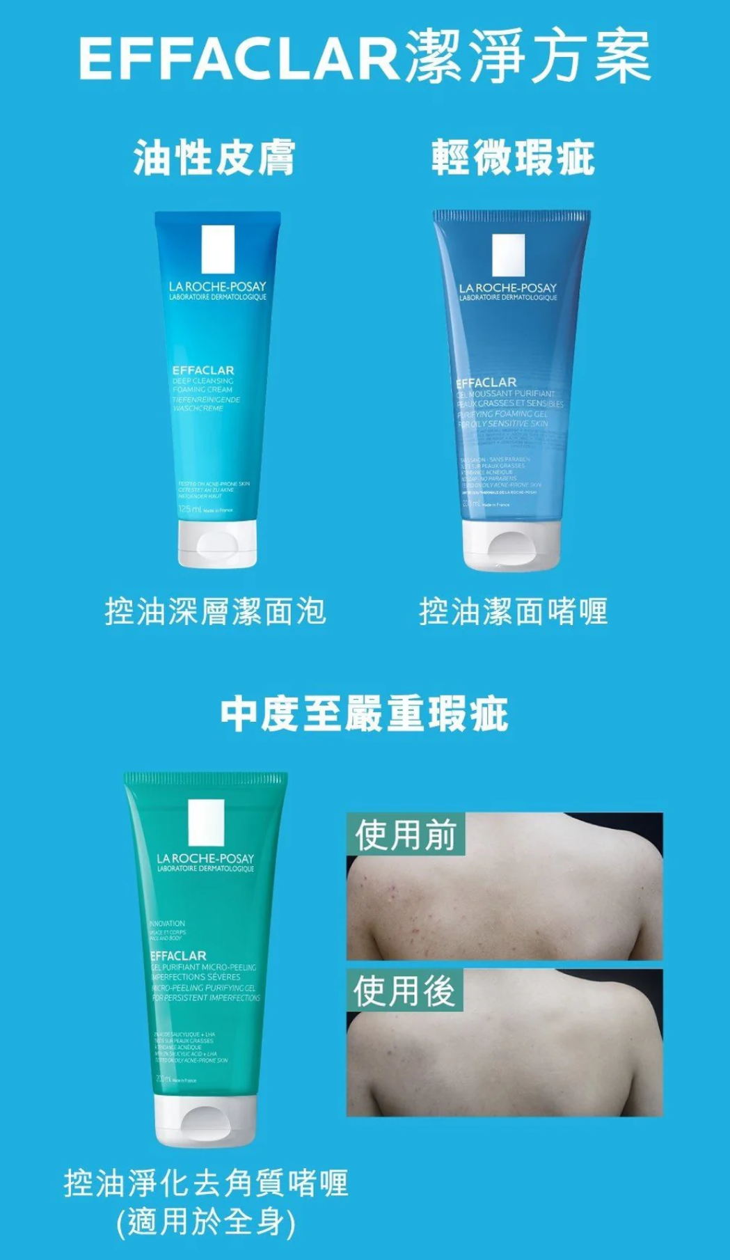 La Roche Posay Effaclar Gel Micro-Peeling 400 ml 控油淨化去角質啫喱 加大裝 系列圖