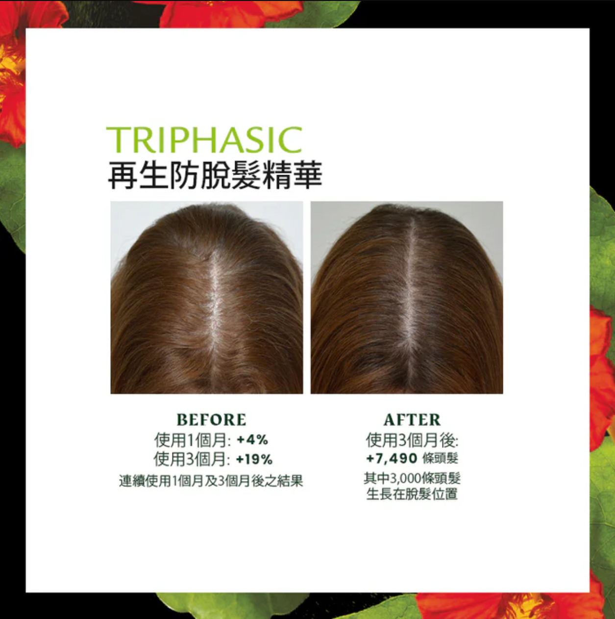 Rene Furterer Triphasic Progressive Serum 防脫髮再生精華素 效果圖