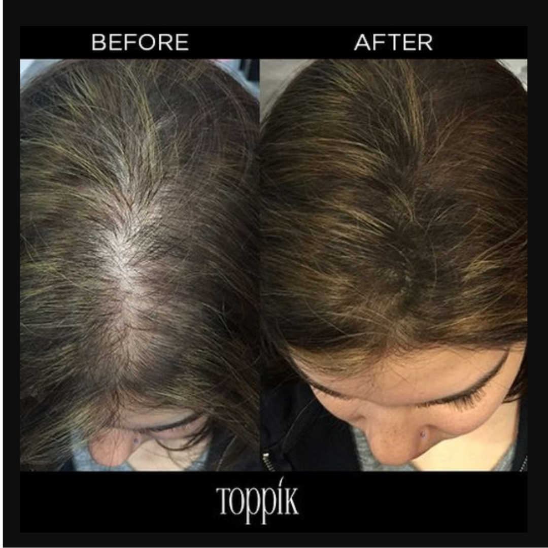 Toppik HAIR BUILDING FIBERS 頂豐增髪纖維 12g(5色可選) 效果圖1